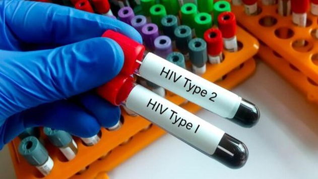 Keprihatinan Kesehatan Usia Muda: Ratusan Pelajar di Sidoarjo Terdata Hidup Dengan HIV